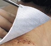 Metalline steriel nonwoven kompres 8 cm x 10 cm - per stuk