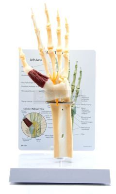 Hand - Pols met Carpaaltunnel syndroom en infokaart