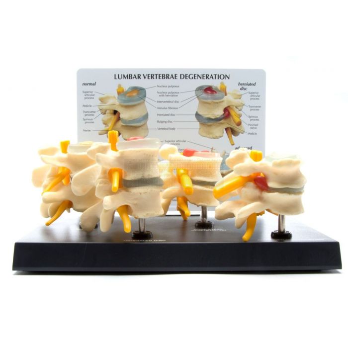 Ruggenwervels, 4 stadia op ware grootte