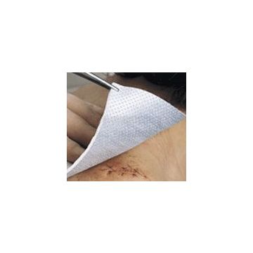 Metalline steriel nonwoven kompres 8 cm x 10 cm