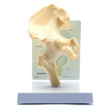 Heup model met info kaart